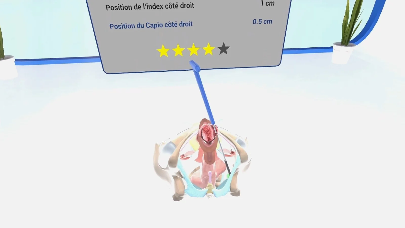 Écran de résultat de la simulation : la position de l'index et celle du Capio sont mesurées en centimètres, et le geste reçoit une note.