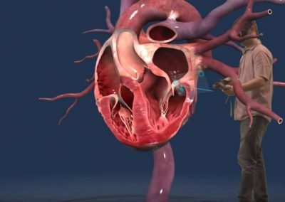 Réalité virtuelle et enseignement - anatomie médecine biologie