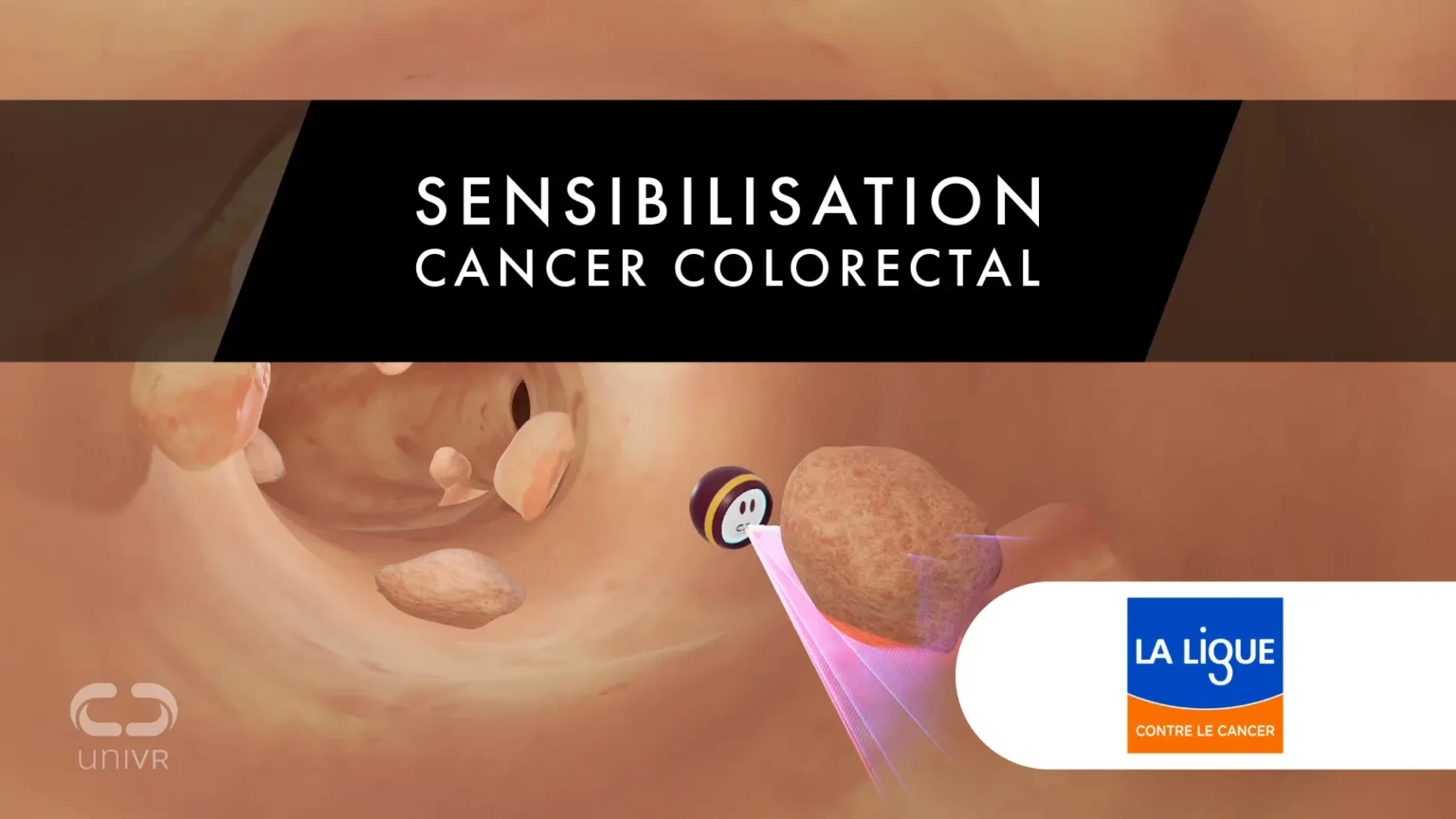 Sensibilisation cancer en réalité virtuelle Sensibilisation cancer en réalité virtuelle