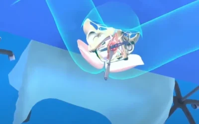 chirurgie virtuelle simulateur chirurgie virtuelle simulateur